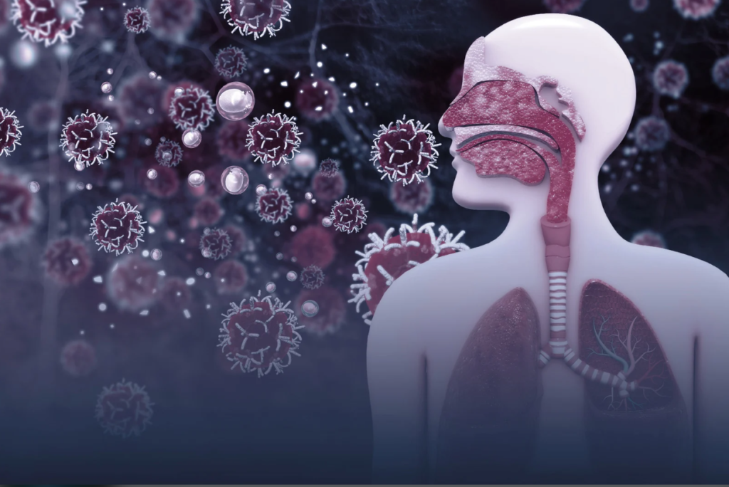 Taking a Deep Breath: Understanding and Combating Lung Infections